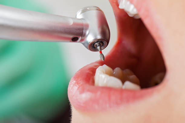 Best Emergency Root Canal Treatment in Mount Repose, OH